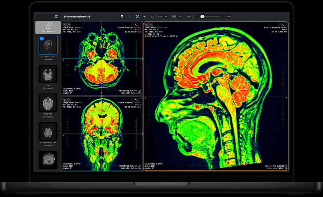Écran d’un MacBook Pro affichant Falcon MD